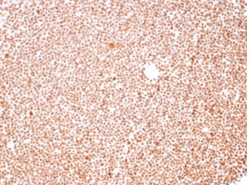 Nucleoli Marker Antibody / Human Nucleolar Antigen