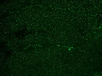 Nucleoli Marker Antibody / Human Nucleolar Antigen