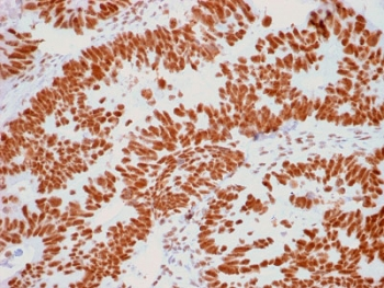Nucleoli Marker Antibody / Human Nucleolar Antigen
