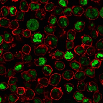 Nucleoli Marker Antibody / Human Nucleolar Antigen