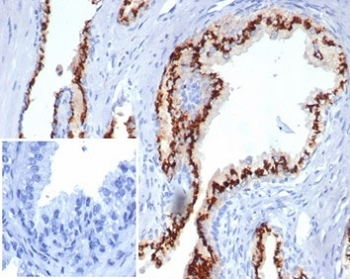 Recombinant Prostein Antibody / SLC45A3