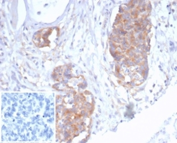 Recombinant p40 Antibody / deltaNp63
