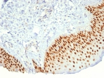 Recombinant p40 Antibody / deltaNp63