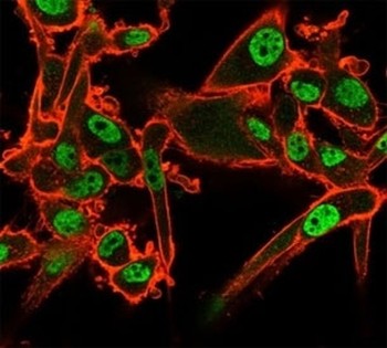 QKI Antibody / Protein Quaking
