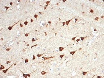 LPLUNC1 Antibody / BPIFB1