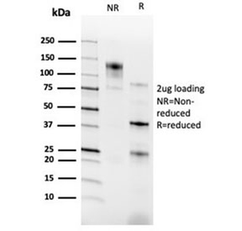 RXR gamma Antibody / RXRG