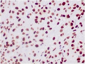 INI1 Antibody / Integrase interactor 1 / SMARCB1 / BAF47