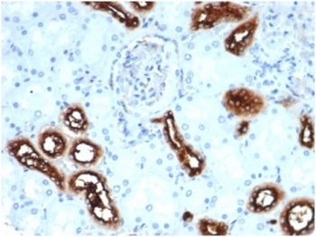 Recombinant FSCN1 Antibody / Fascin 1