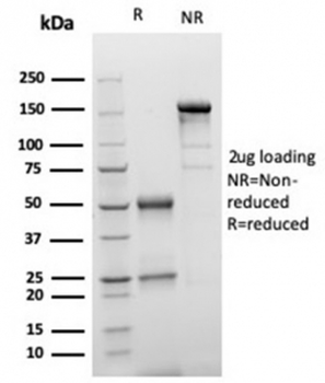 S100 beta Antibody