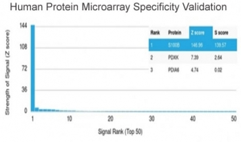 S100 beta Antibody