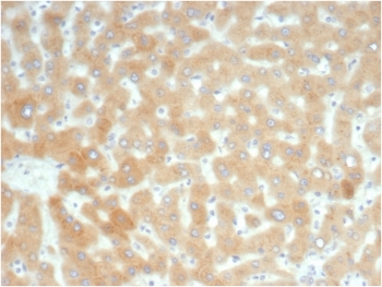 Recombinant Retinol Binding Protein 4 Antibody / RBP4