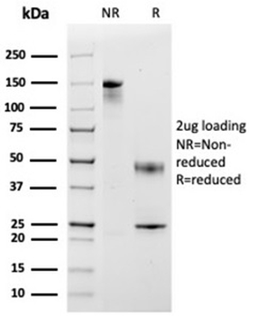 CCL8 Antibody / MCP2