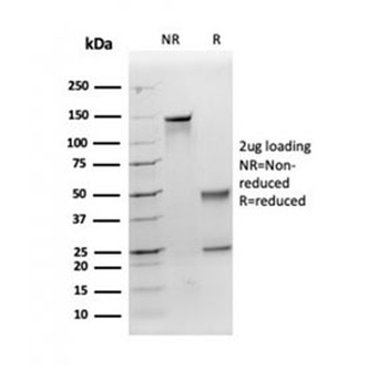 Apolipoprotein E Antibody / APOE