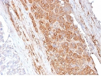 Apolipoprotein E Antibody / APOE
