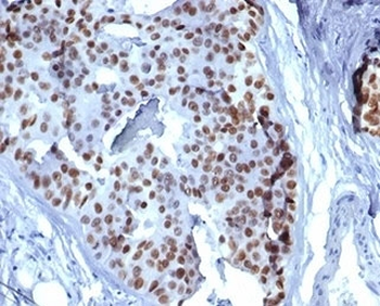 GATA Binding Protein 3 Antibody / GATA-3