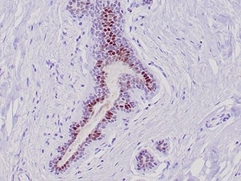 GATA Binding Protein 3 Antibody / GATA-3