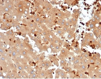 Recombinant Fatty Acid Binding Protein 5 Antibody / FABP5