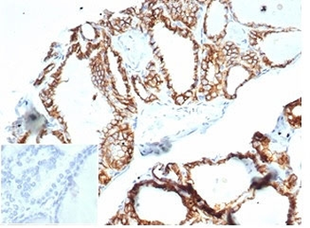 Recombinant CDH16 Antibody / Cadherin 16