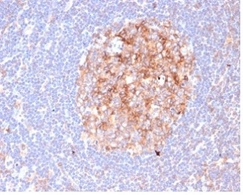 Recombinant CD86 Antibody