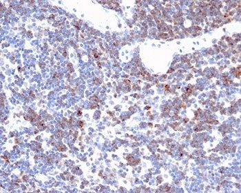 Recombinant CD2 Antibody