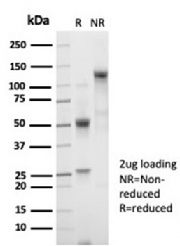 Recombinant B2M Antibody / Beta-2 Microglobulin
