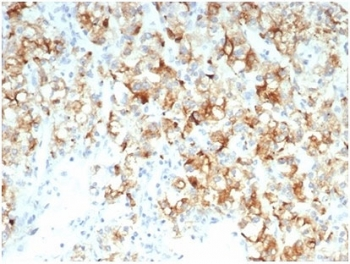 Recombinant Cdc20 Antibody