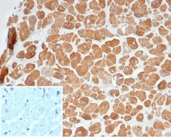 Recombinant Alpha Actinin 2 Antibody / ACTN2 / Sarcomeric Alpha Actinin