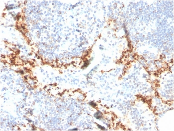 HAVCR2 Antibody / TIM-3