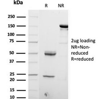 S100B Antibody