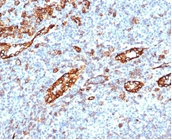 Recombinant PECAM-1 Antibody / CD31