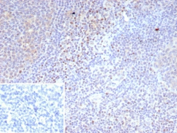 Recombinant LEF1 Antibody / Lymphoid enhancer-binding factor 1 / TCF1 alpha