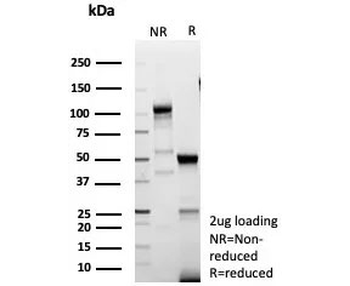 Recombinant LEF1 Antibody / Lymphoid enhancer-binding factor 1 / TCF1 alpha