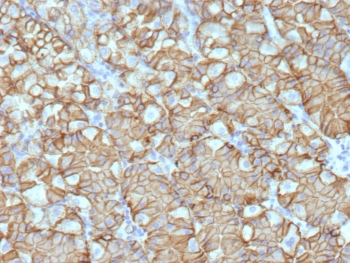 Recombinant Carbonic Anhydrase IX Antibody / CA9