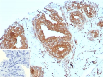 CD161 Antibody / KLRB1