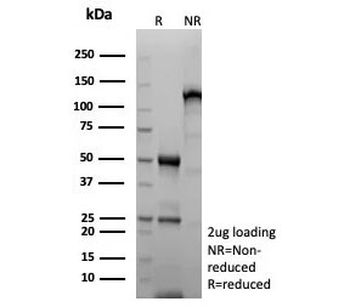 Recombinant MDM2 Antibody