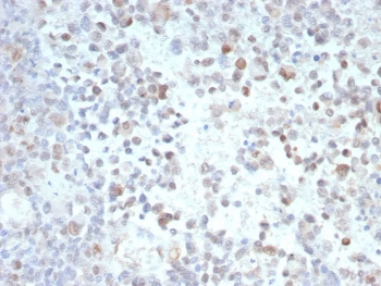 Opa-interacting protein 4 Antibody / OIP-4 / PRAME