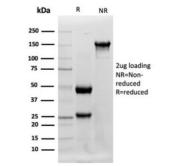 Lysozyme Antibody