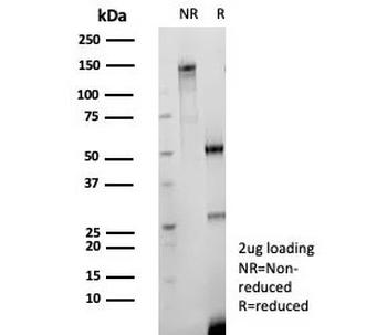 Recombinant CD147 Antibody / Basigin / Emmprin