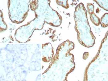 Recombinant CD147 Antibody / Basigin / Emmprin