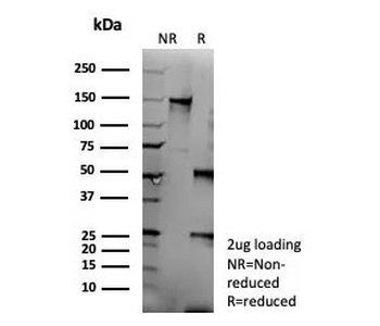 Recombinant CD95 Antibody