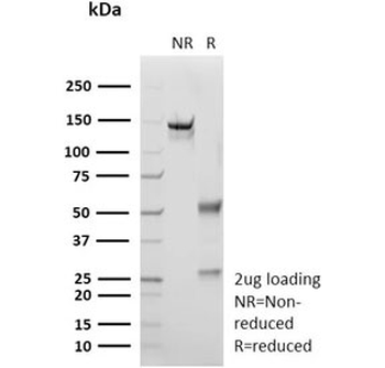 Recombinant S100A1 Antibody