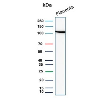 Recombinant E-Cadherin Antibody / CDH1