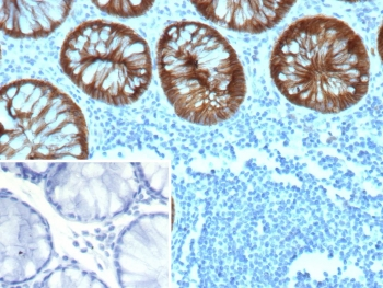 Recombinant E-Cadherin Antibody / CDH1