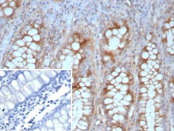 Recombinant E-Cadherin Antibody / CDH1