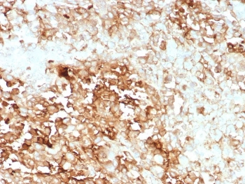 Recombinant CLU Antibody / Clusterin / Apolipoprotein J