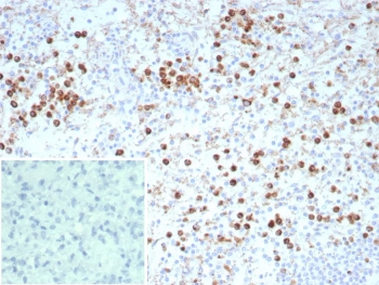 Recombinant LAMP-3 Antibody / CD63