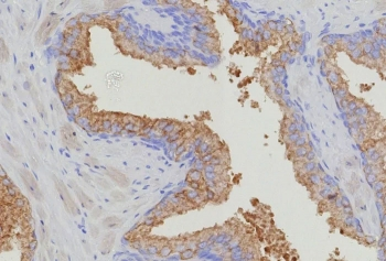 Recombinant Thymidylate Synthase Antibody / TYMS