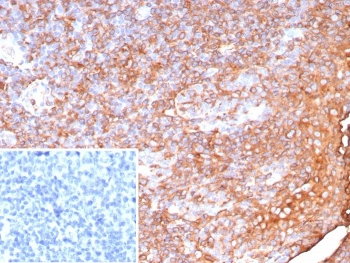 Recombinant HLA-DP/DQ/DR Antibody / MHC II