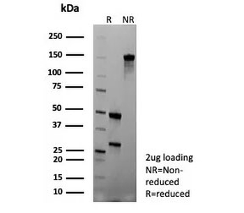 Colipase Antibody / CLPS