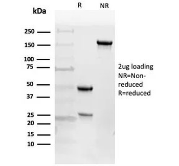 EGFR Antibody / EGF Receptor